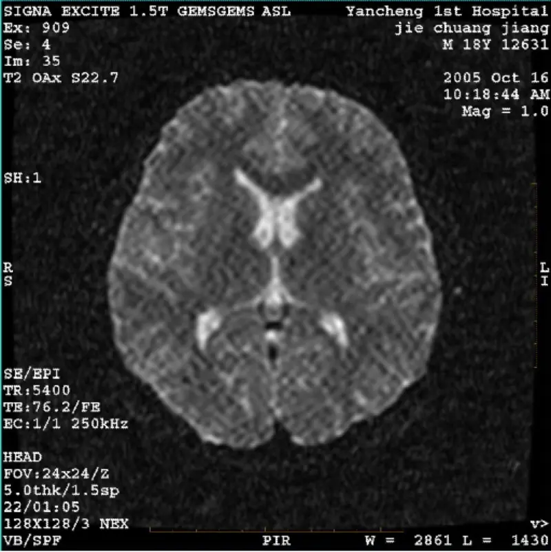 Obrázok ARTIFACT WI/Fiesta Biely pixel
